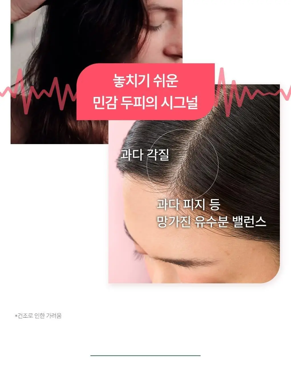 [민감두피 & 두피진정 앰플] 클로란 피오니 두피 SOS 세럼 100ml 상세페이지 5